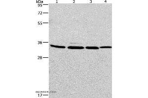 Western blot analysis of A549, 231, PC3 and hela cell, using MAD2L1BP Polyclonal Antibody at dilution of 1:675