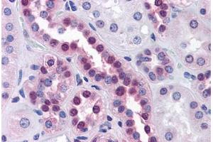 Human Kidney: Formalin-Fixed, Paraffin-Embedded (FFPE)