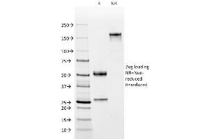 SDS-PAGE Analysis Purified Complement 4d Mouse Monoclonal Antibody (C4D204). (C4A anticorps  (CF®488A))