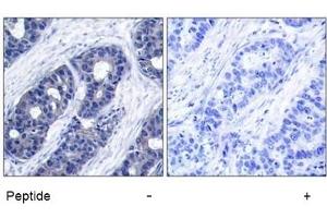 Image no. 1 for anti-Insulin Receptor Substrate 1 (IRS1) (Ser636) antibody (ABIN197467) (IRS1 anticorps  (Ser636))