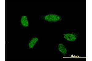 Immunofluorescence of monoclonal antibody to ATOH1 on HeLa cell. (ATOH1 anticorps  (AA 266-354))
