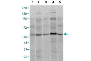 Western blot analysis of SMAD4 monoclonal antobody, clone 4G1C6  against A-431 (1), SK-N-SH (2), K-562 (3), HepG2 (4) and HUVE12 (5) cell lysate.