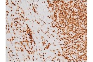 ABIN6267604 at 1/200 staining Human tonsil tissue sections by IHC-P. (c-Rel anticorps  (pSer503))