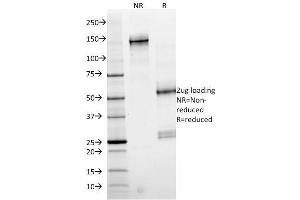 SDS-PAGE Analysis Purified SMAD4 Mouse Monoclonal Antibody (SMAD4/2524). (STAT6 anticorps)
