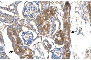 Human kidney; SLC17A2 antibody - middle region in Human kidney cells using Immunohistochemistry (SLC17A2 anticorps  (Middle Region))