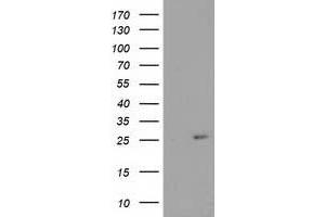Western Blotting (WB) image for anti-Cyclin-Dependent Kinase Inhibitor 3 (CDKN3) antibody (ABIN1497457) (CDKN3 anticorps)