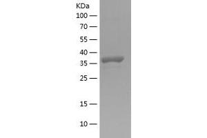 Western Blotting (WB) image for Angiopoietin-Like 2 (ANGPTL2) (AA 23-135) protein (His-IF2DI Tag) (ABIN7121830)