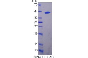 Image no. 1 for DnaJ (Hsp40) Homolog, Subfamily B, Member 1 (DNAJB1) (AA 2-340) protein (His tag) (ABIN6239979)
