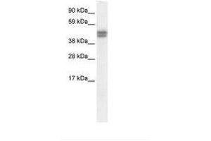 Image no. 1 for anti-SAP30 Binding Protein (SAP30BP) (AA 35-84) antibody (ABIN6736065) (SAP30BP anticorps  (AA 35-84))