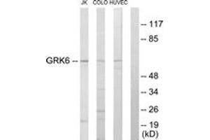Western Blotting (WB) image for anti-G Protein-Coupled Receptor Kinase 6 (GRK6) (AA 10-59) antibody (ABIN2889479) (GRK6 anticorps  (AA 10-59))