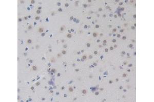 Used in DAB staining on fromalin fixed paraffin- embedded brain tissue (CEBPD anticorps  (AA 51-251))