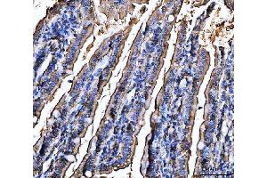IHC analysis of CD13/Anpep using anti-CD13/Anpep antibody (ABIN7602222).