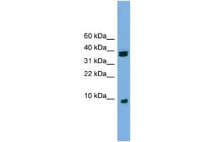 WB Suggested Anti-RPS21 Antibody Titration: 0. (RPS21 anticorps  (Middle Region))