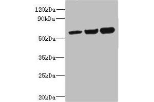 Western blot All lanes: OSBPL2 antibody at 1 μg/mL Lane 1: HepG2 whole cell lysate Lane 2: Mouse heart tissue Lane 3: Hela whole cell lysate Secondary Goat polyclonal to rabbit IgG at 1/10000 dilution Predicted band size: 56, 54 kDa Observed band size: 56 kDa (OSBPL2 anticorps  (AA 251-480))
