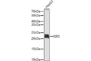 Western blot analysis of extracts of HepG2 cells, using IGF2 antibody (ABIN3022872, ABIN3022873, ABIN3022874 and ABIN6219274) at 1:1000 dilution. (IGF2 anticorps  (AA 25-180))