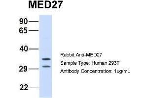 Host: Rabbit Target Name: MED27 Sample Type: 293T Antibody Dilution: 1.