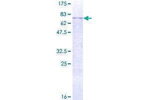 Image no. 1 for Matrix Metallopeptidase 12 (Macrophage Elastase) (MMP12) (AA 1-470) protein (GST tag) (ABIN1311062)