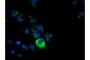 Immunofluorescence (IF) image for anti-alpha-Fetoprotein (AFP) antibody (ABIN1496486) (alpha Fetoprotein anticorps)