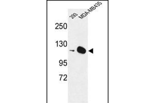 DIAPH2 anticorps  (AA 870-899)
