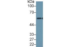 Detection of ALDH1B1 in Human Hela cell lysate using Polyclonal Antibody to Aldehyde Dehydrogenase 1 Family, Member B1 (ALDH1B1)