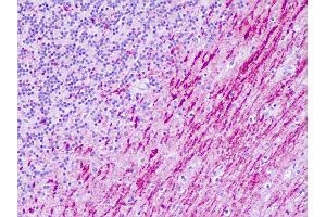 Human, Brain, Cerebellum: Formalin-Fixed Paraffin-Embedded (FFPE)