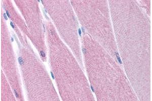 Human Skeletal Muscle (formalin-fixed, paraffin-embedded) stained with PDK4 antibody ABIN214801 at 5 ug/ml followed by biotinylated goat anti-rabbit IgG secondary antibody ABIN481713, alkaline phosphatase-streptavidin and chromogen.