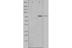 Western blot analysis of extracts from HeLa cells, using CEP78 antibody. (CEP78 anticorps  (Internal Region))