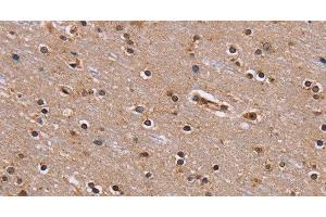 Immunohistochemistry of paraffin-embedded Human brain using GNL3 Polyclonal Antibody at dilution of 1:60