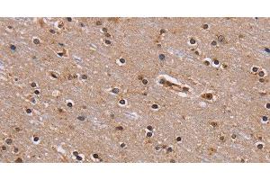 Immunohistochemistry of paraffin-embedded Human brain using GNL3 Polyclonal Antibody at dilution of 1:60 (Nucleostemin anticorps)