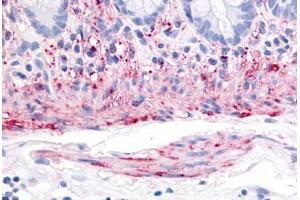 Human Colon, Smooth Muscle (formalin-fixed, paraffin-embedded) stained with TACR2 antibody ABIN213477 at 20 ug/ml followed by biotinylated goat anti-rabbit IgG secondary antibody ABIN481713, alkaline phosphatase-streptavidin and chromogen.