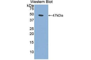 Western Blotting (WB) image for anti-Phospholipase A2, Group IIA (Platelets, Synovial Fluid) (PLA2G2A) (AA 22-146) antibody (ABIN1860250) (PLA2G2A anticorps  (AA 22-146))