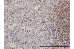 Immunoperoxidase of monoclonal antibody to PSCD1 on formalin-fixed paraffin-embedded human spleen.