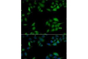 Immunofluorescence analysis of MCF7 cells using HIP1 Polyclonal Antibody (HIP1 anticorps)