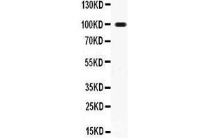 Anti- RANK Picoband antibody, Western blotting All lanes: Anti RANK  at 0. (TNFRSF11A anticorps  (AA 35-214))