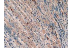 IHC-P analysis of Mouse Stomach Tissue, with DAB staining. (TOLLIP anticorps  (AA 19-254))