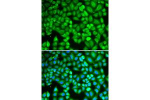 Immunofluorescence analysis of U2OS cell using WAS antibody. (WASP anticorps)