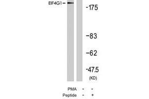Western blot analysis of extract from 293 cells, using EIF4G1 polyclonal antibody . (EIF4G1 anticorps  (Ser1232))