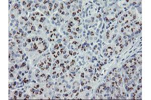 anti-THAP Domain Containing 6 (THAP6) antibody