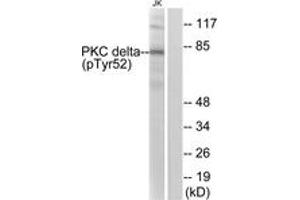 Western blot analysis of extracts from Jurkat cells treated with starved 24h, using PKC delta (Phospho-Tyr52) Antibody. (PKC delta anticorps  (pTyr52))