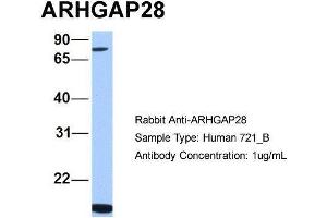 Human 721_B; Host:Rabbit. (ARHGAP28 anticorps  (C-Term))
