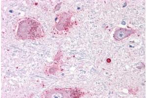 Anti-CHRM3 / M3 antibody  ABIN1048442 IHC staining of human brain, neurons and glia. (CHRM3 anticorps  (C-Term))
