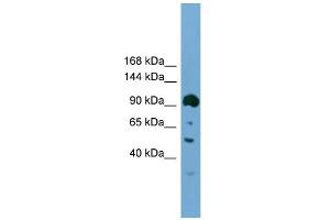 WB Suggested Anti-Ddx20 Antibody Titration:  0. (DDX20 anticorps  (N-Term))