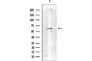 Western blot analysis of lysates from Mouse lung, using PKC alpha Mouse Monoclonal Antibody at 1/1000 dilution.