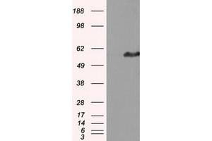 Western Blotting (WB) image for anti-Intraflagellar Transport 57 Homolog (IFT57) antibody (ABIN1498808) (IFT57 anticorps)