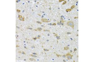 Immunohistochemistry of paraffin-embedded mouse spinal cord using CCT4 antibody (ABIN2561655) at dilution of 1:100 (40x lens). (CCT4 anticorps)