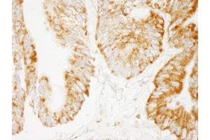 Immunohistochemistry (IHC) image for anti-Cytochrome C Oxidase Subunit IV Isoform 1 (COX4I1) (AA 25-75) antibody (ABIN7454792)