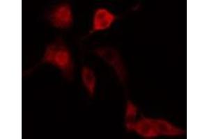 ABIN6277185 staining  Hela cells by IF/ICC. (IFIH1 anticorps  (C-Term))