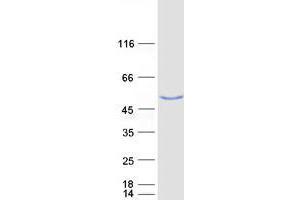 Validation with Western Blot