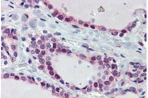 Thyroid, Human: Formalin-Fixed, Paraffin-Embedded (FFPE)