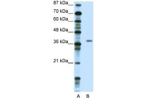 WB Suggested Anti-ZNF444 Antibody Titration:  2. (ZNF444 anticorps  (C-Term))